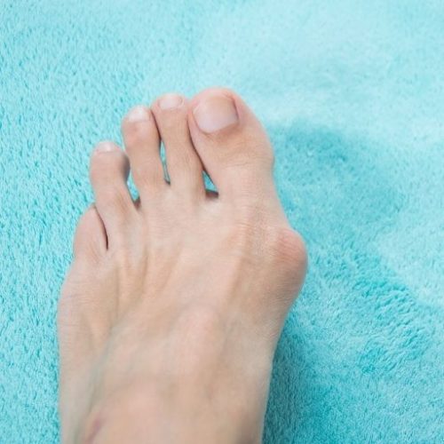 11 Best Tennis Shoes for Bunions (2021) Men's & Women's Guide